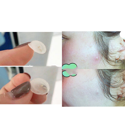 Korean Olive Young Invisible Acne Patch 102 Invisible Patch