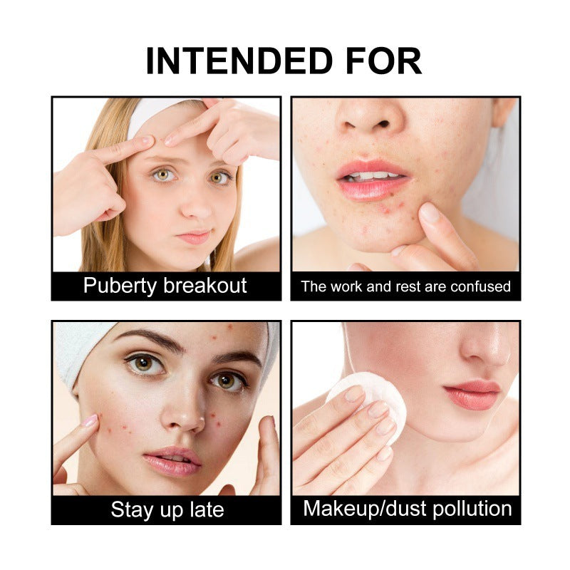 Cute Black Acne Cover Patch Reduces Spots